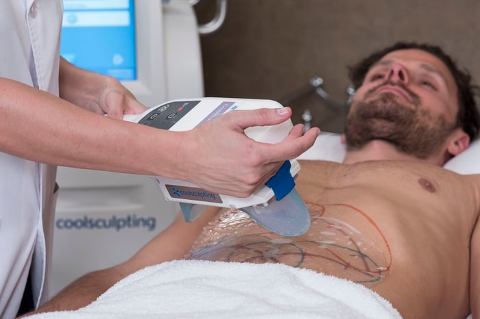 coolsculpting