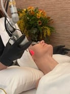 laser-co2-coolpeel
